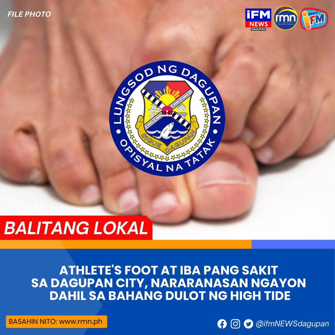 Athlete S Foot At Iba Pang Sakit Sa Dagupan City Nararanasan Ngayon