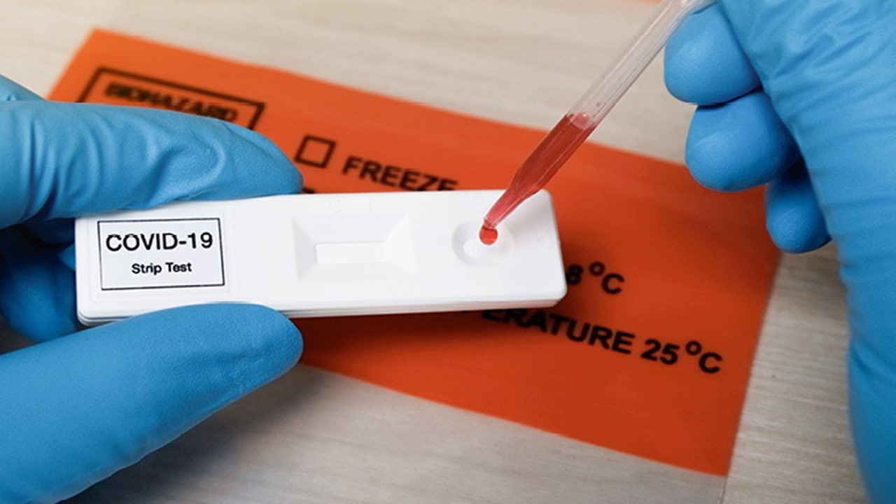 DOH, nagbabala kaugnay ng selfhome antigen test kits RMN Networks