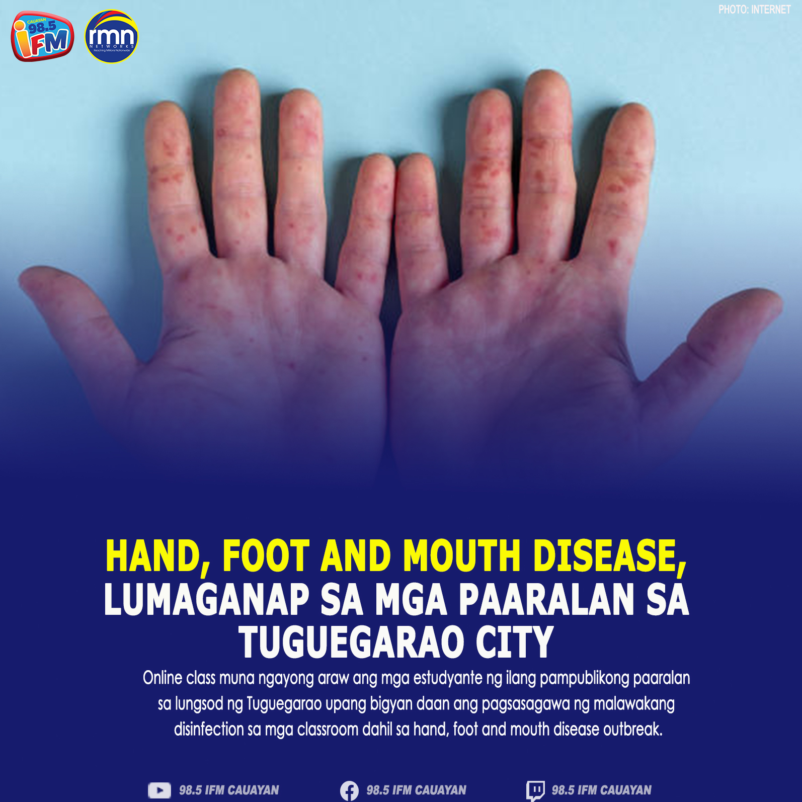 HFMD.jpg RMN Networks